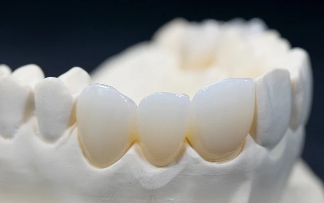 Реставрации из циркония Yucera 4D Pro